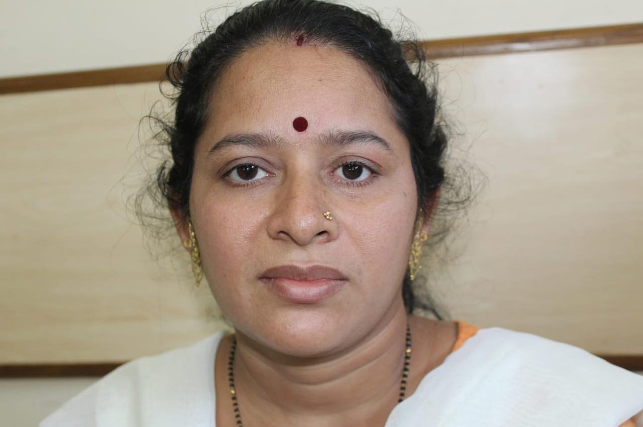 Before and after patient results with a custom artificial eye prosthesis