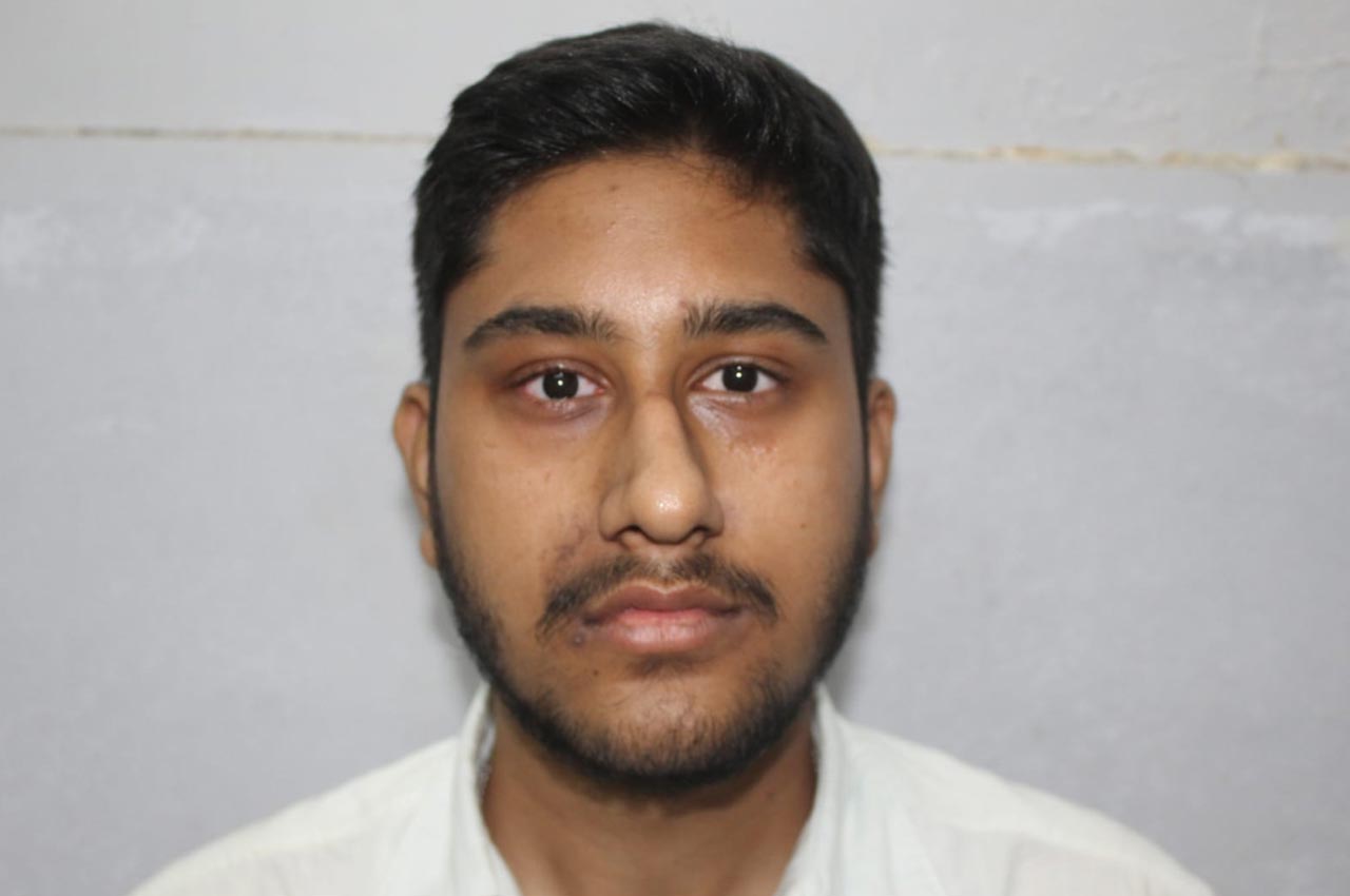 Before and after patient results with a custom artificial eye prosthesis