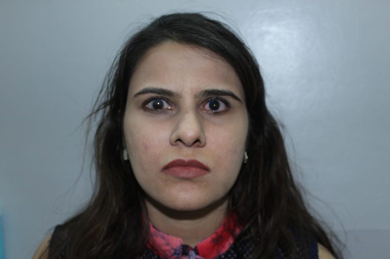 Before and after patient results with a custom artificial eye prosthesis